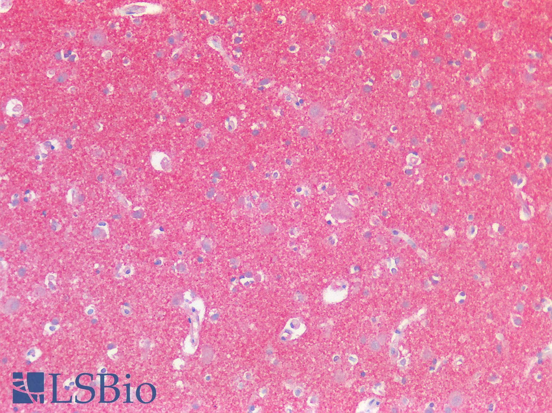 PathPlus™ SERPINB7 / MEGSIN Antibody (aa98-147)