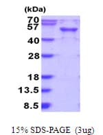 Human GRAB / RAB3IL1 Protein (Recombinant His)