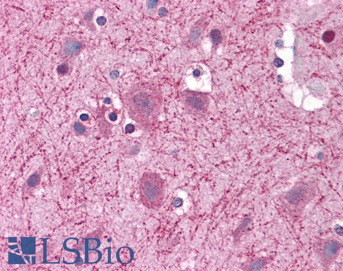 IHC-plus™ CCT2 / CCT Beta Antibody