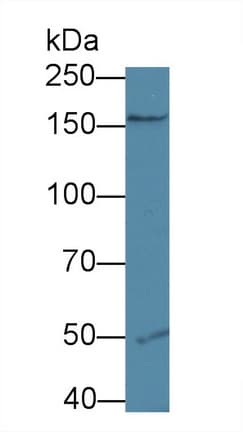 KDR / VEGFR2 / FLK1 Antibody (aa8-290, PE)