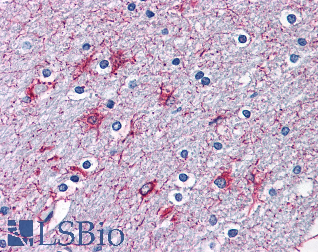 IHC-plus™ P2RX7 / P2X7 Antibody (aa13-26)