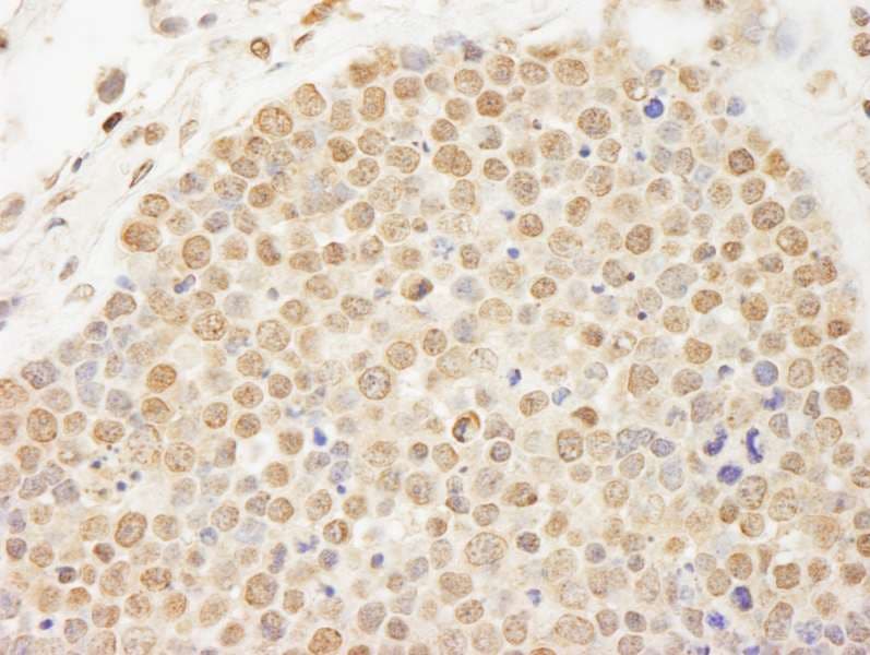 TOP2B / Topoisomerase II Beta Antibody (aa1570-C-term)