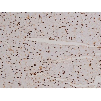 FAK / Focal Adhesion Kinase Antibody (phospho-Tyr397)
