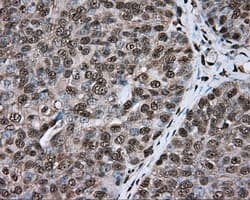 ERCC1 Antibody (clone OTI2H5)