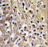 CYP19 / Aromatase Antibody (aa453-485)