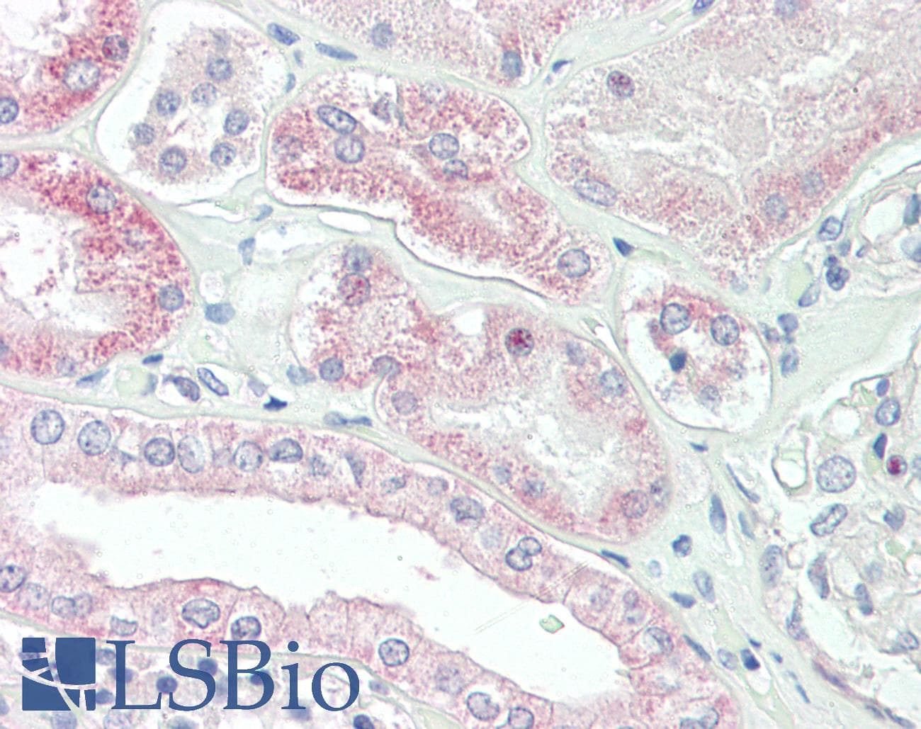 IHC-plus™ SLC4A11 / NABC1 Antibody (aa136-150)