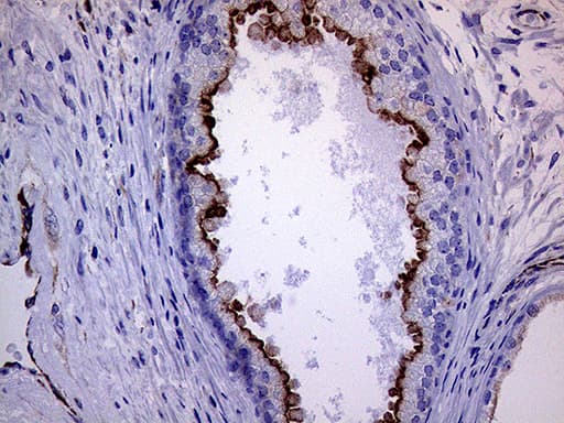 MLPH / Melanophilin Antibody (aa295-600, clone OTI6E3)