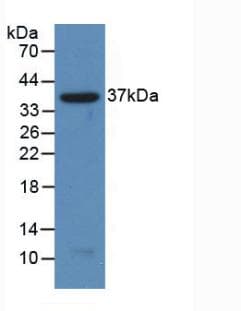 NFKB2 Antibody (aa38-343, PE)