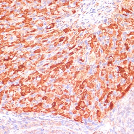 Polyclonal Rabbit anti-Human ASNS Antibody (IHC)