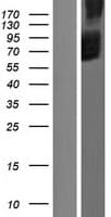 SLC34A3 / NaPi-2c Protein (Over-Expression Lysate Myc-DDK (Flag))