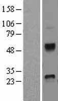DKK4 Protein (Over-Expression Lysate Myc-DDK (Flag))