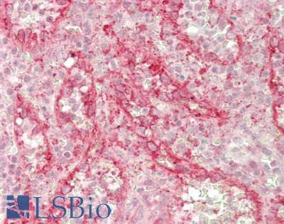 IHC-plus™ Polyclonal Rabbit anti-Human FKBP1A / FKBP12 Antibody (IHC, WB)
