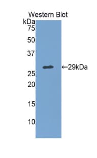 MPS1 / TTK Antibody (aa570-787, PE)