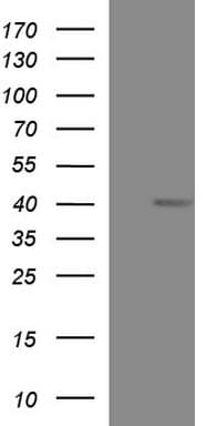 MCAT Antibody (clone OTI2H4)