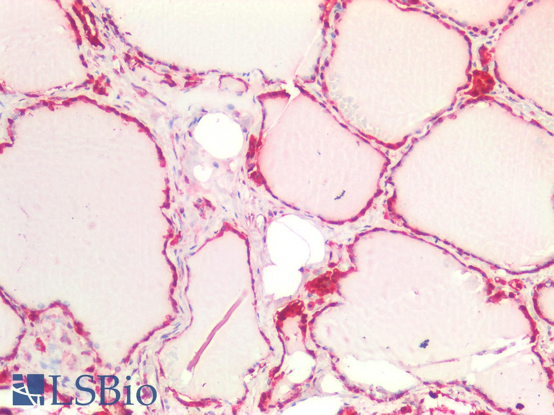 PathPlus™ GSTP1 / GST Pi Antibody (clone OTI4B6)