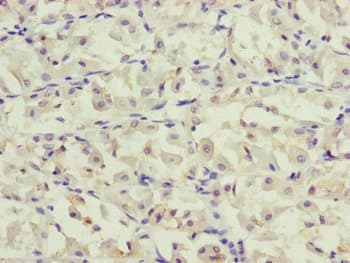 Polyclonal Rabbit anti-Human PPP2R3C Antibody (IHC, WB)