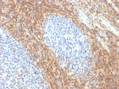 CD52 Antibody (clone CD52/2276R)