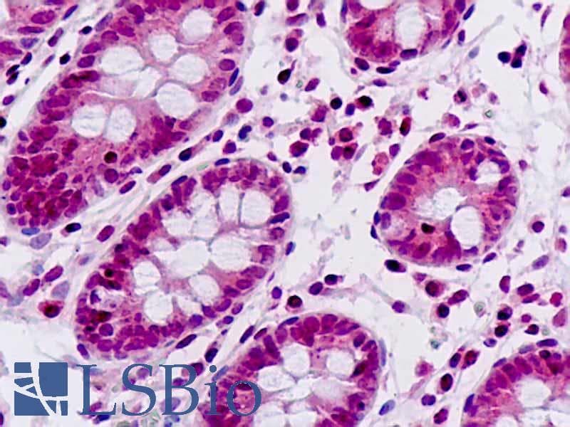 IHC-plus™ Polyclonal Rabbit anti-Human GRG4 / TLE4 Antibody (aa161-210, IHC, WB)
