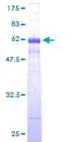 Human CCND1 / Cyclin D1 Protein (Recombinant GST)
