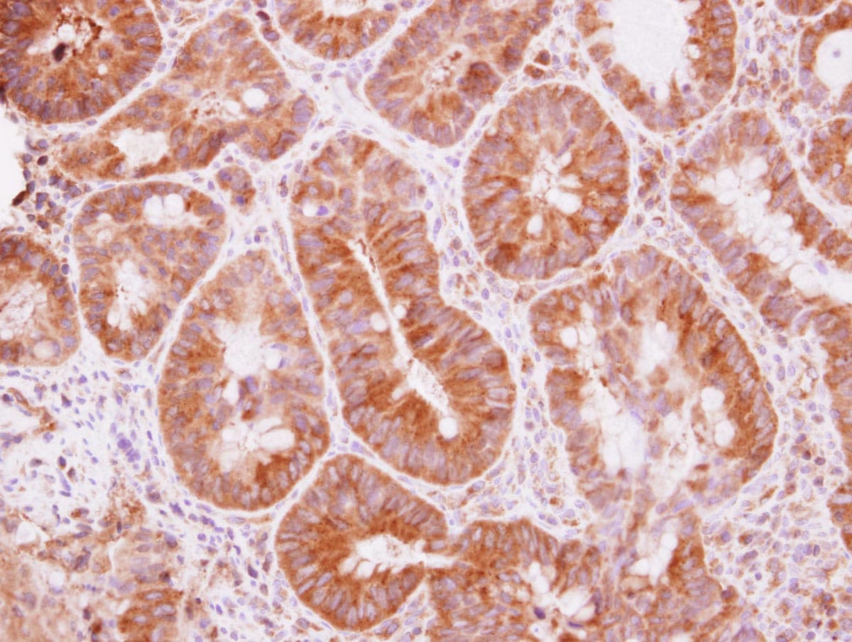 TRIM25 Antibody