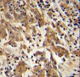 GKAP1 Antibody (aa331-359)