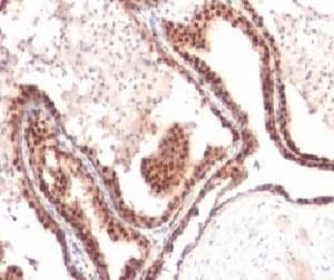 CDKN1B / p27 Kip1 Antibody (clone KIP27-1, Ready-to-Use)