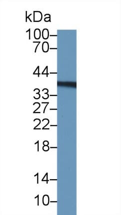 TS / Thymidylate Synthase Antibody (aa36-313, Biotin)