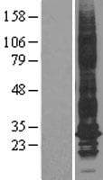 AQP1 / Aquaporin 1 Protein (Over-Expression Lysate Myc-DDK (Flag))