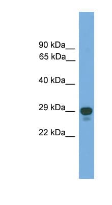Polyclonal Rabbit anti-Human PRRX2 / PRX2 Antibody (aa71-120, WB)