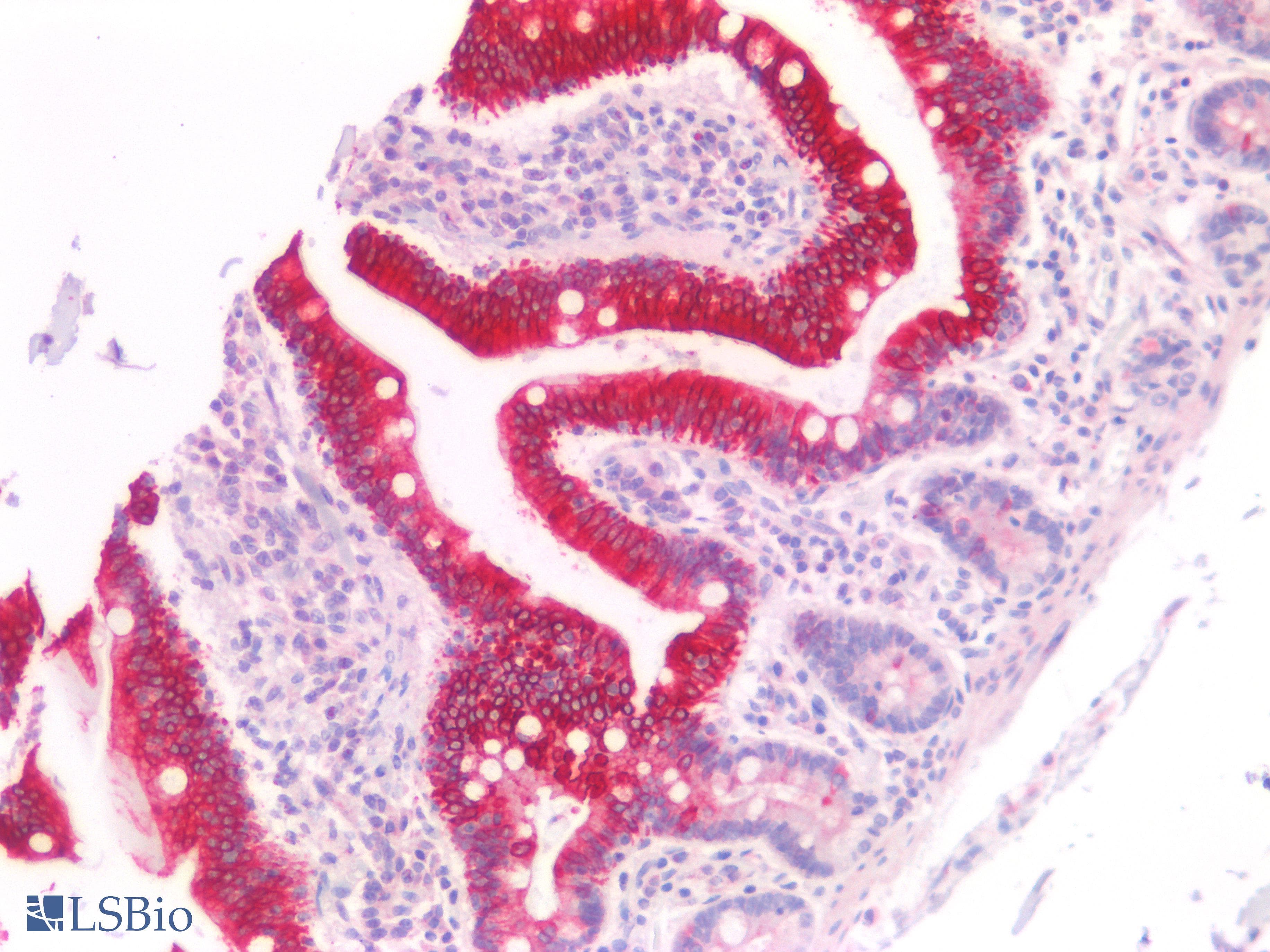 PathPlus™ KRT20 / CK20 / Cytokeratin 20 Antibody