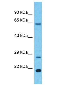 LRRC18 Antibody (aa60-109)