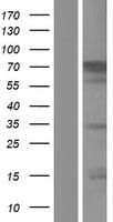 CACNB2 Protein (Over-Expression Lysate Myc-DDK (Flag))