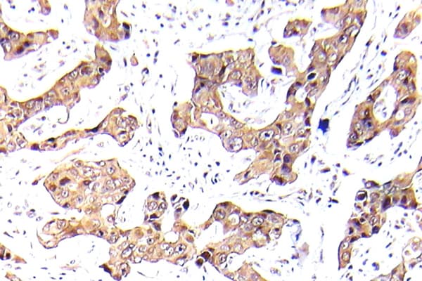 FOXO1 / FKHR Antibody (phospho-Ser256)