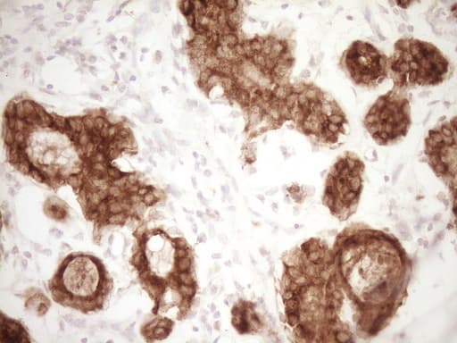 Monoclonal Mouse anti-Human MGP / Matrix Gla-Protein Antibody (clone 11G8, Carrier-free, IHC, WB)
