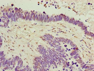 C6orf141 Antibody