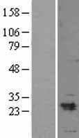 MYL3 Protein (Over-Expression Lysate Myc-DDK (Flag))