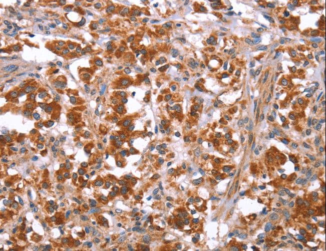 GLMN Antibody