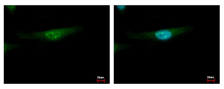 IHC-plus™ MSY2 / YBX2 Antibody (Internal)