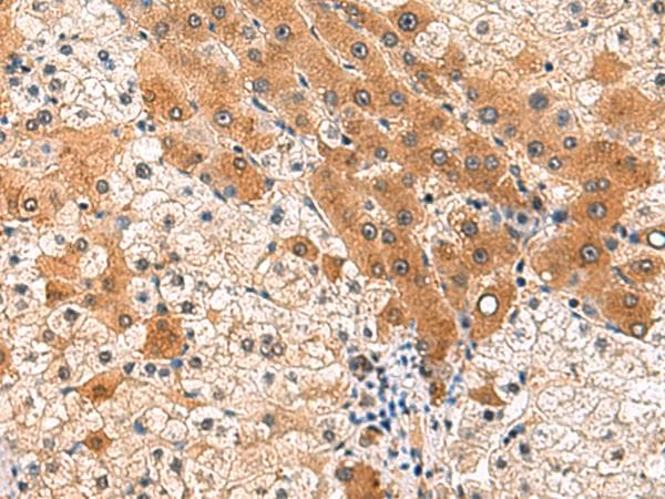 Polyclonal Rabbit anti-Human PCYT2 / ET Antibody (IHC)