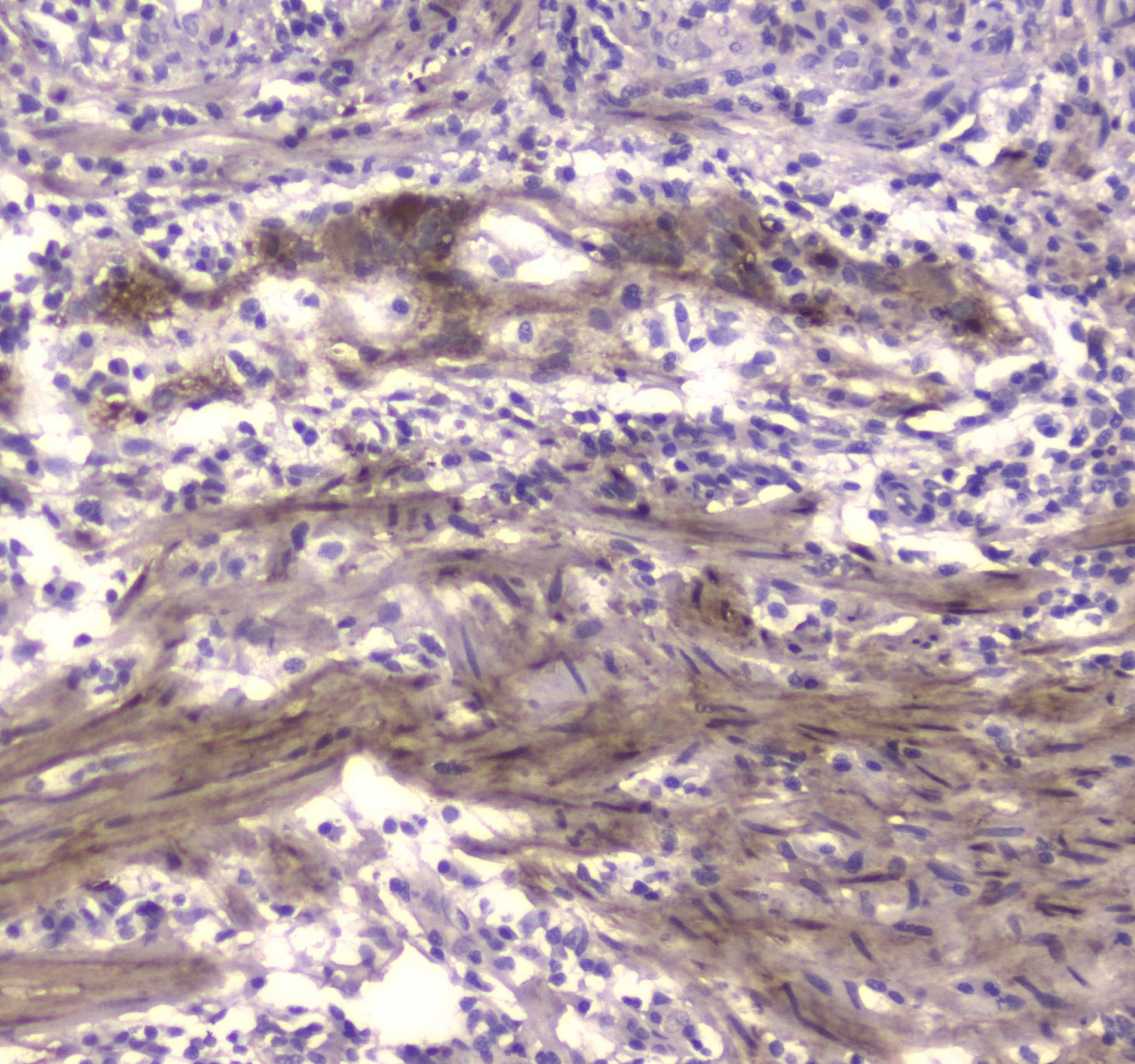 CKB / Creatine Kinase BB Antibody