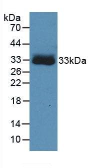 HBB / Hemoglobin Beta Antibody (aa1-145)