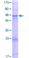Human GHITM Protein (Recombinant GST)