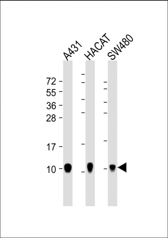 Monoclonal Mouse anti-Human S100A2 Antibody (clone 1592CT417.84.81, WB)