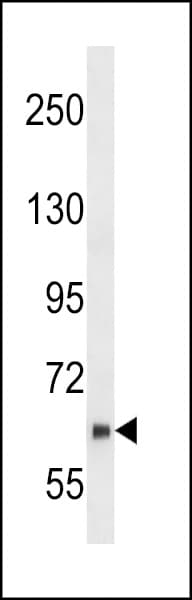Polyclonal Rabbit anti-Human NUB1 Antibody (aa87-117, IHC, WB)