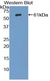 ADRBK1 / GRK2 Antibody (aa398-640, APC)