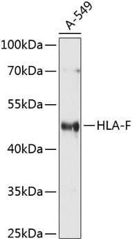 HLA-F Antibody