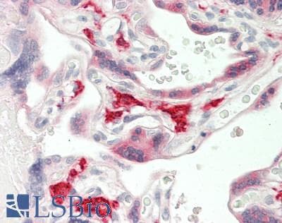 CD163 Antibody (clone 2F8, Carrier-free)
