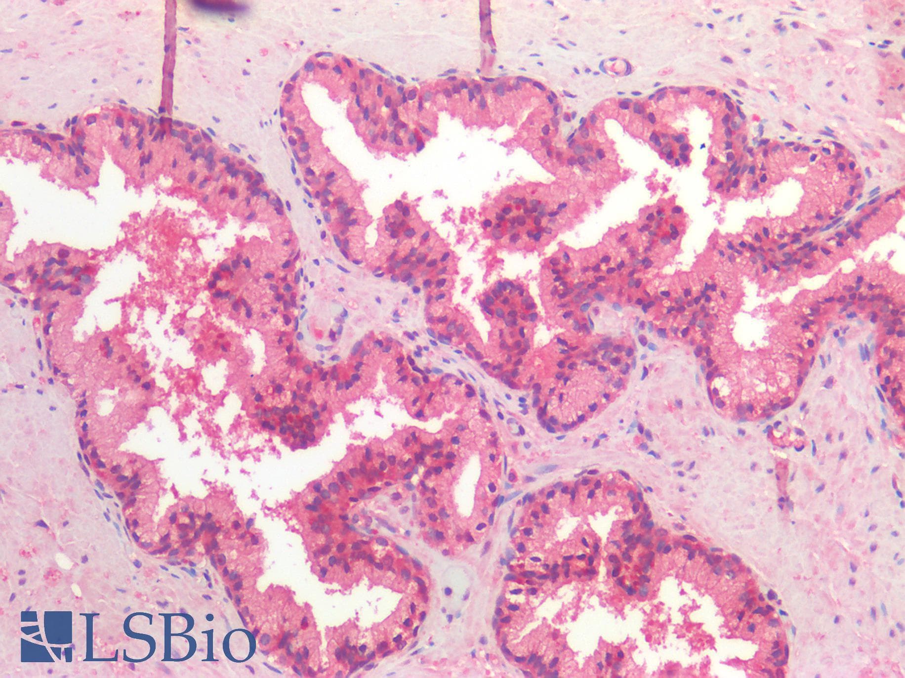 IHC-plus™ Polyclonal Rabbit anti-Human HDAC6 Antibody (IHC)