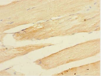 Polyclonal Rabbit anti-Human TOB2 Antibody (IHC)