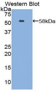 NTN1 / Netrin 1 Antibody (aa313-565)